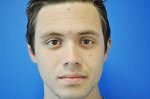 Otoplasty