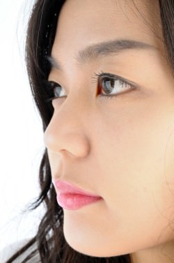 Nose Surgery